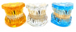 Модель челюсти с болезнями зубов